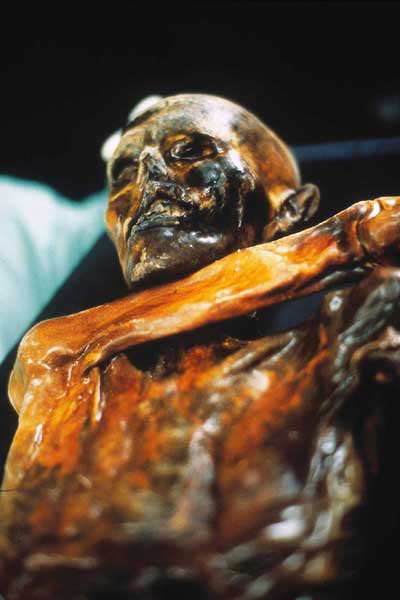 Oetzi the Iceman