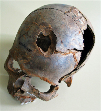 Germany: Bronze Age Battle Site